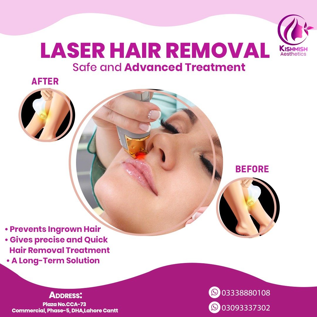You are currently viewing Laser Hair Removal
